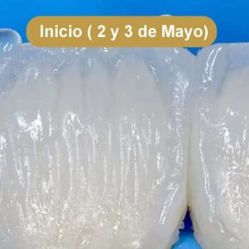 Anteriores: Restauraciones Directas. Curso modular